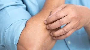 Body itching
