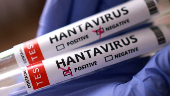 HANTA VIRUS